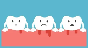 Chảy máu chân răng là bệnh gì?