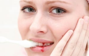 Chảy máu chân răng sau khi làm răng sứ. Tại sao và cách khắc phục?